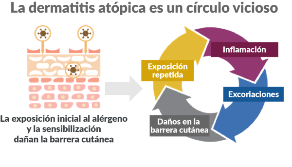 img-infographic-atopic-dermatitis.png Diagrama de la barrera cutanea de los perros y el ciclo de la dermatitis atópica